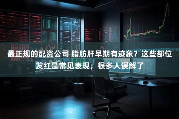 最正规的配资公司 脂肪肝早期有迹象？这些部位发红是常见表现，很多人误解了